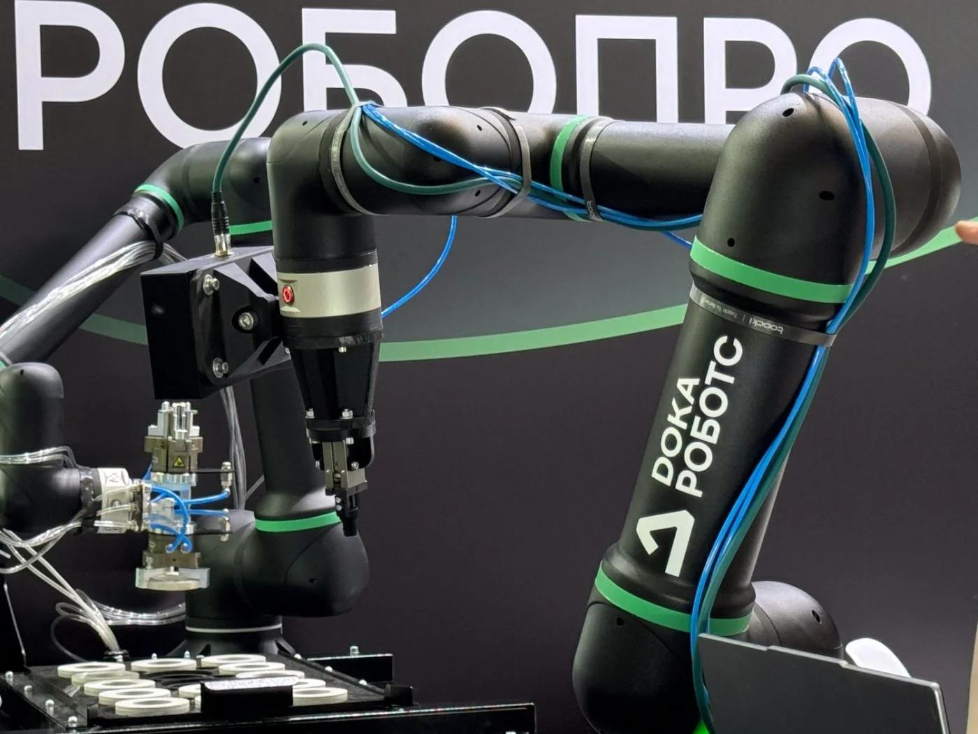 Rusiya istehsalı olan "DOKA RC5" robotu ilk dəfə insan üzərində 3D-bioprint icra edib